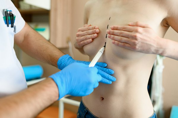Tout savoir sur la chirurgie esthétique des seins